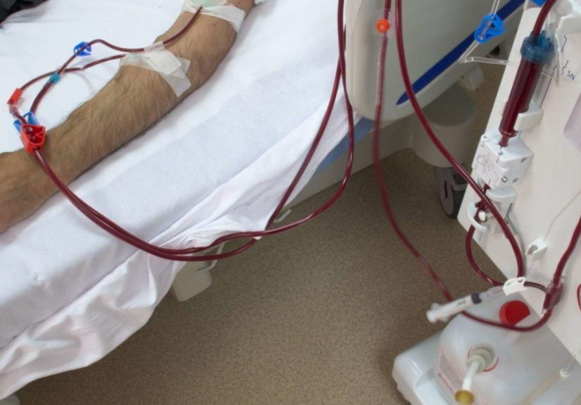 Acute renal failure: Symptoms and causes