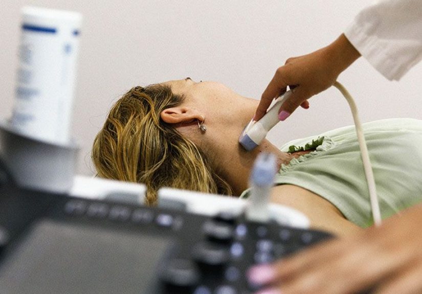 How are lupus and hyperthyroidism related?