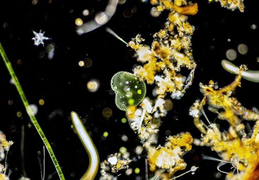 Parasitic infections: Types, symptoms, treatment