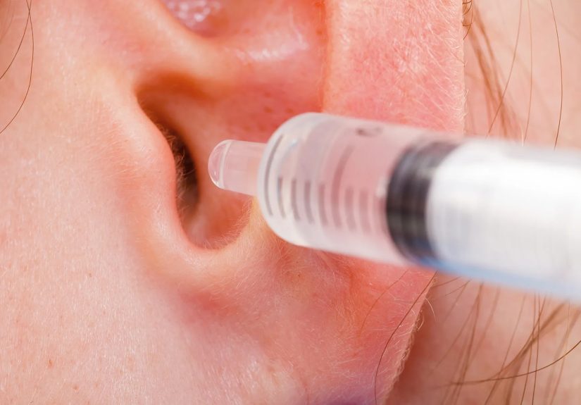 Why You Have Earwax