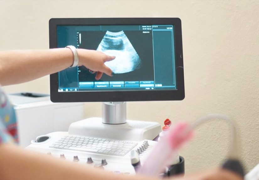 16-Week Ultrasound: What to Expect and What You'll See
