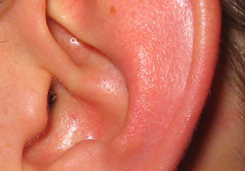 #741 When a big chunk of ear wax randomly falls out of your ear - 1000 Awesome Things