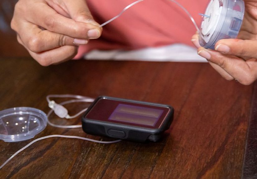 A Guide to Insulin Pumps and New Diabetes Technology