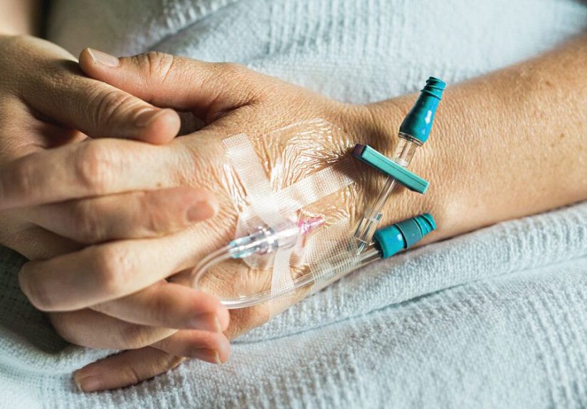 ABVD Chemotherapy for Hodgkin’s Lymphoma