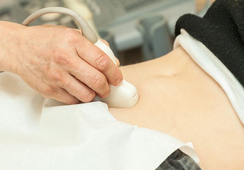 Bicornuate Uterus: Symptoms, Effects on Pregnancy, and More