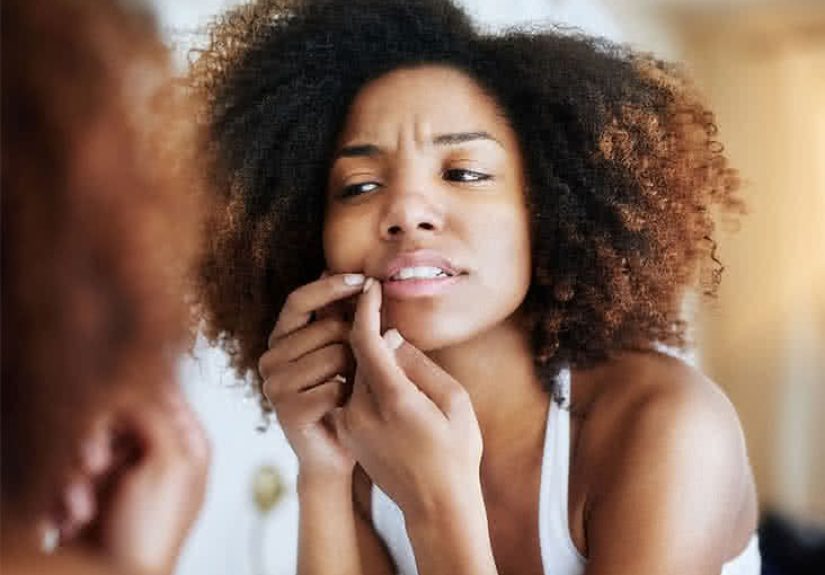 Espinillas ciegas debajo de la piel: 6 formas de tratarlas
