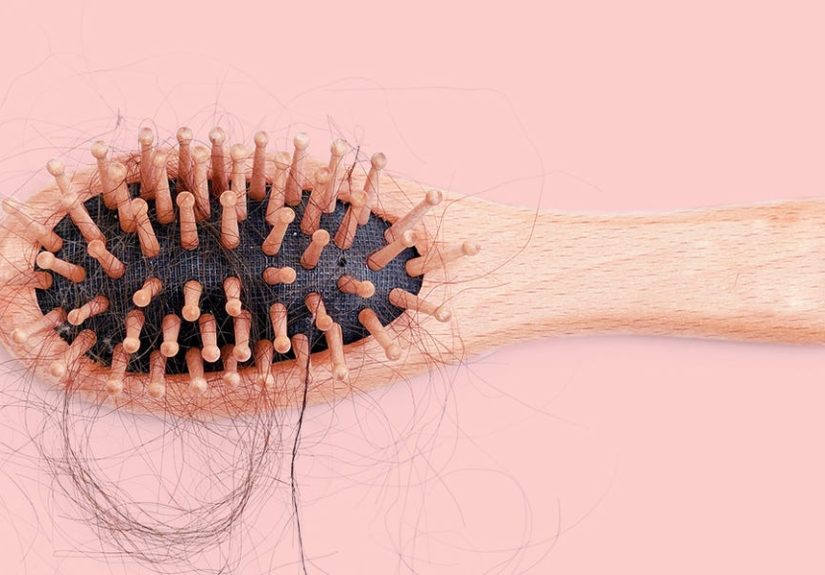 Hair Loss in Women Guide: Causes and Treatment for Thinning Hair and Alopecia