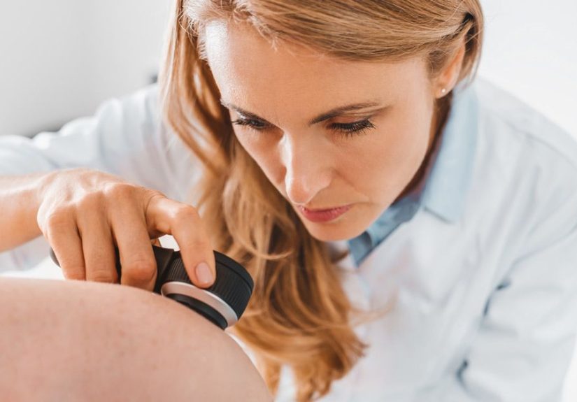How Is Melanoma Diagnosed?