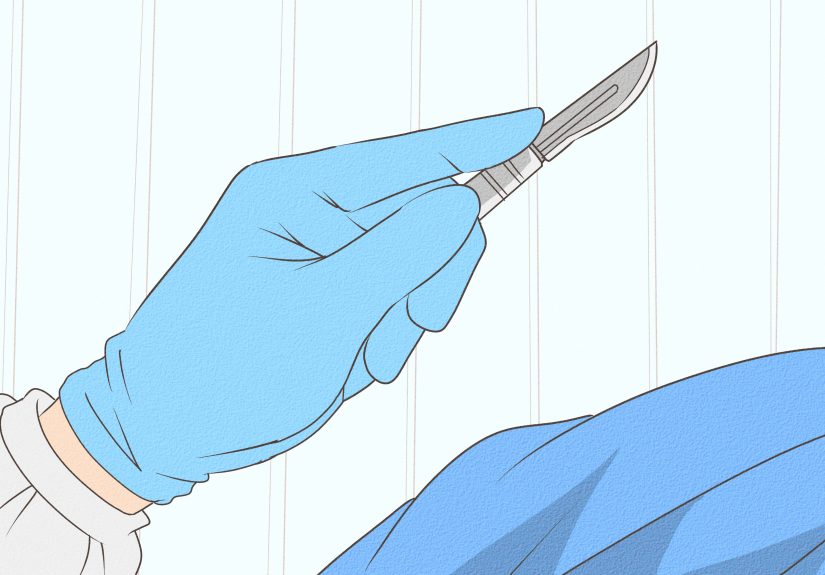 How to Heal a Pulled Trapezius Muscle
