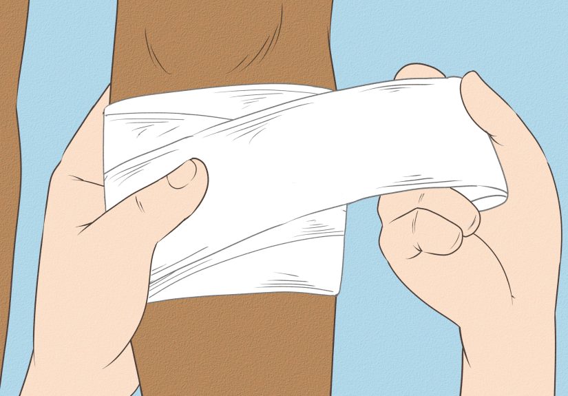 How to Treat an Open Wound: 15 Steps