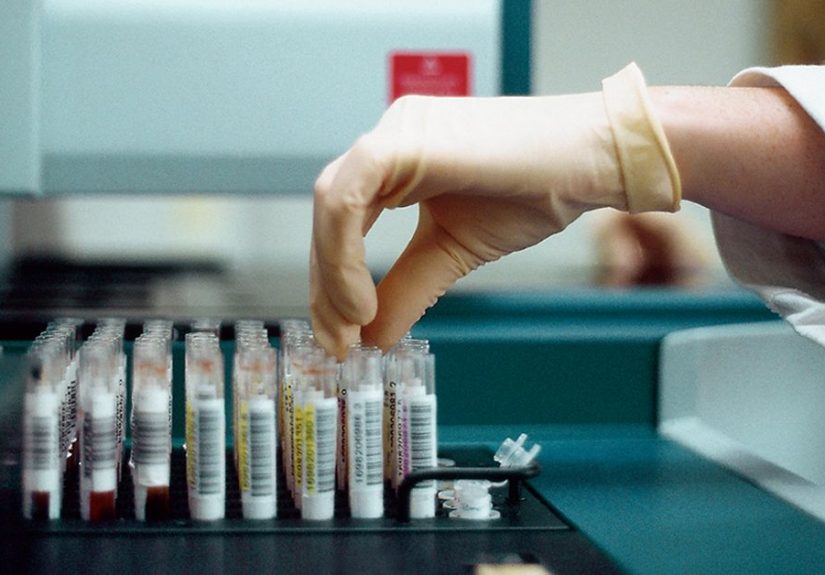 Is a Negative HIV Test at 6 Weeks Conclusive? Answers and More