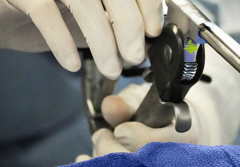 Types of Vocal Cord Surgery: Cost, Recovery, Side Effects