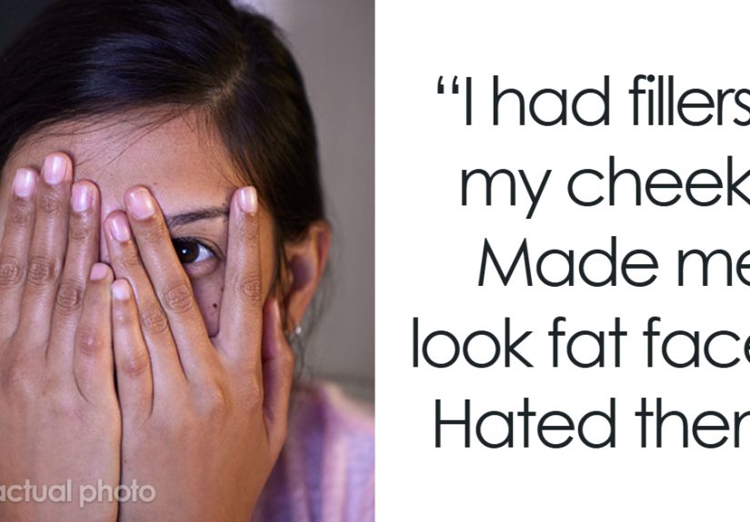 22 People Share Their Botched Plastic Surgery Stories, And Some Are Heartbreaking