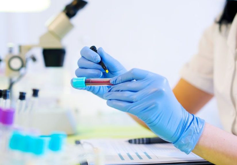 CO2 Blood Test: Purpose, Procedure, and Results