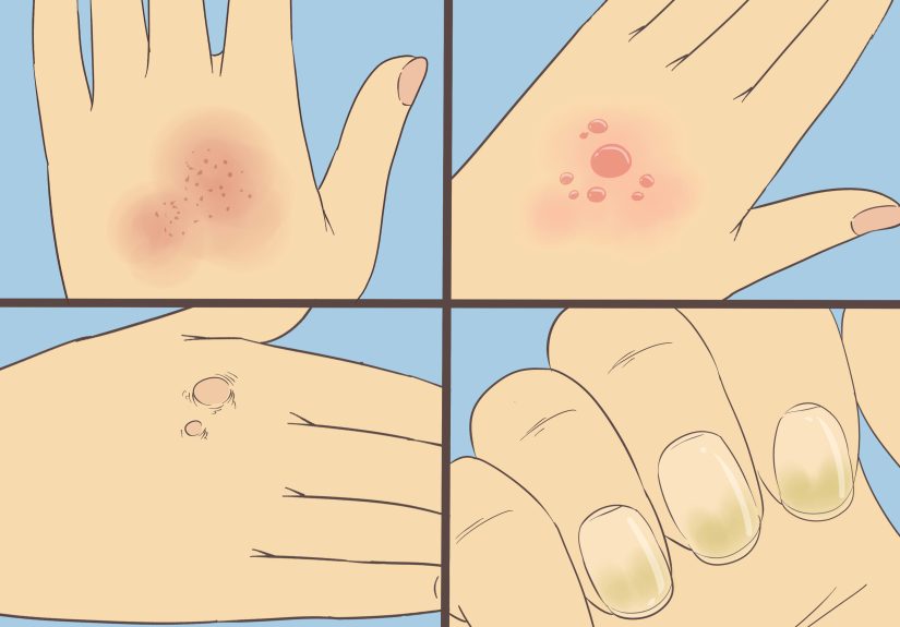 How to Make Hands Look Younger: 13 Steps