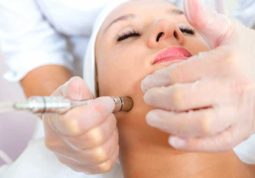 Microdermabrasion: Procedure, Side Effects, and Cost