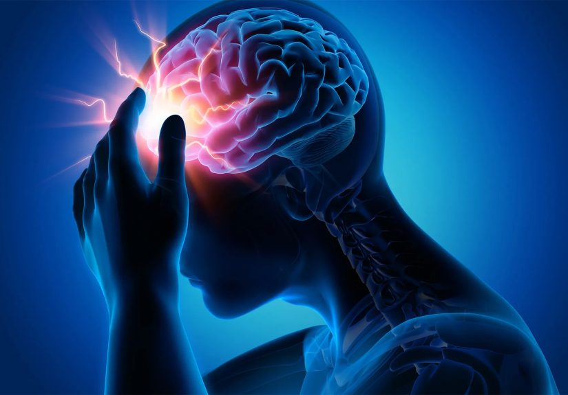 Migraine Myths and Facts