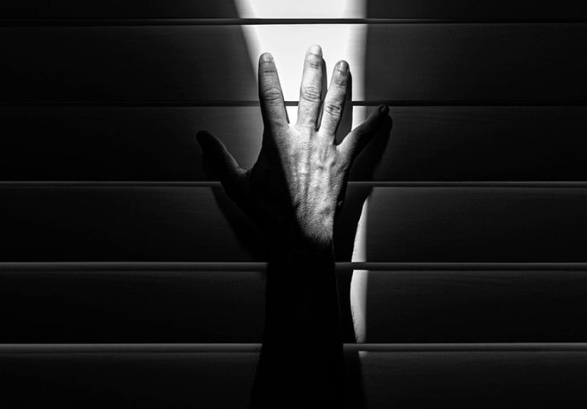 Split hand syndrome in ALS: Causes and treatment
