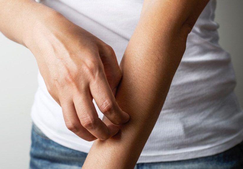 Sulfa Allergy: Drug List, Symptoms, Treatment, and More