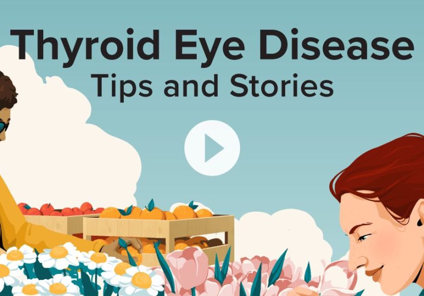 Thyroid Eye Disease Tips and Stories