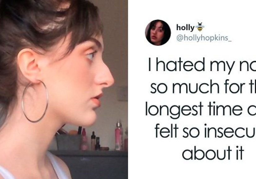 Women Are Posting Their Noses That Look Like “Before” Photos