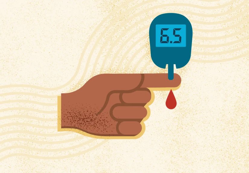 Diabetes: Symptoms, Causes, Diagnosis, Treatment, and Prevention