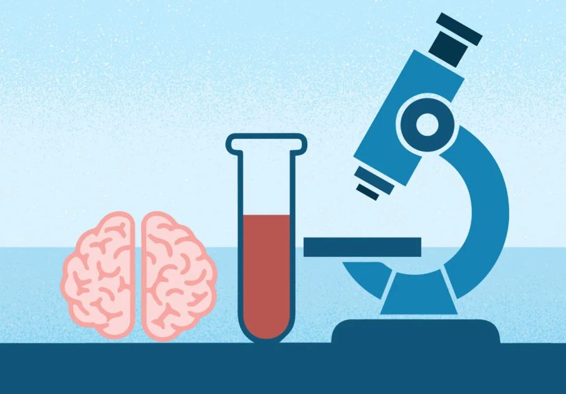 Elecsys Blood Test for Alzheimer’s Gets FDA Clearance