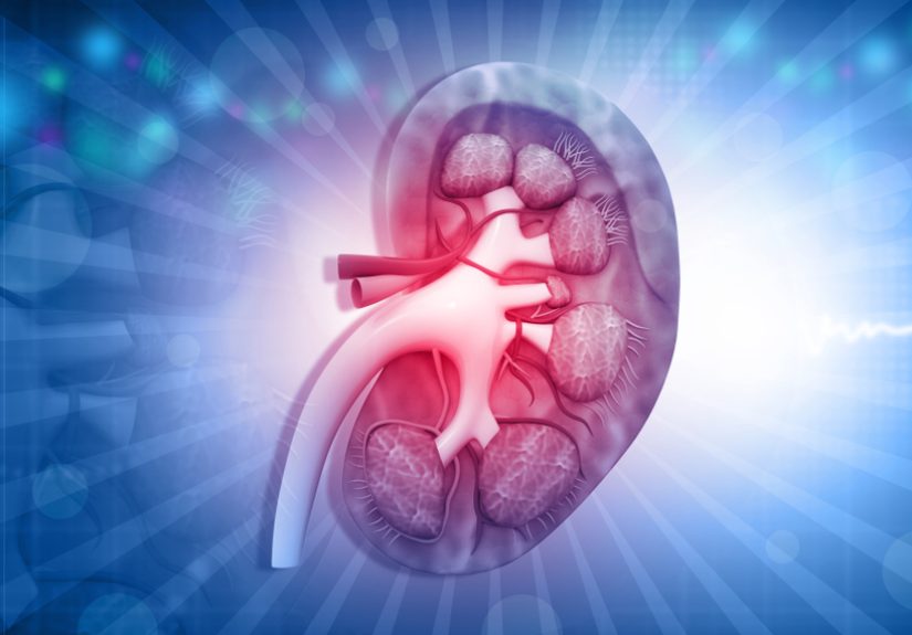 Kidney disease patients deserve better, and so do their doctors
