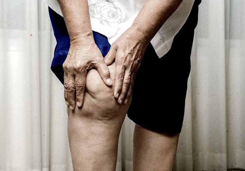 Tendinitis (tendonitis): Types, symptoms, causes, and treatment